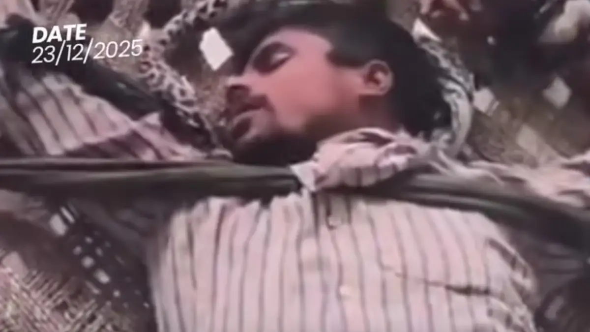 ಬೀದಿ ನಾಯಿ ಕಚ್ಚಿದ ವ್ಯಕ್ತಿ ನಾಯಿಯಂತೆ ವರ್ತನೆ..?! ಆತಂಕಕಾರಿ ವೈರಲ್ Video ನೋಡಿ