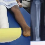 Doddaballapura: Miscreants Annoyance during Raghu Dixit's program