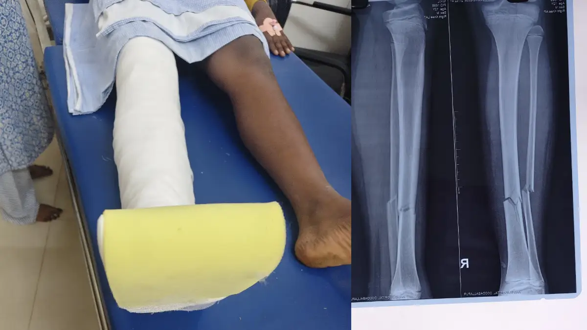 Doddaballapura: Miscreants Annoyance during Raghu Dixit's program